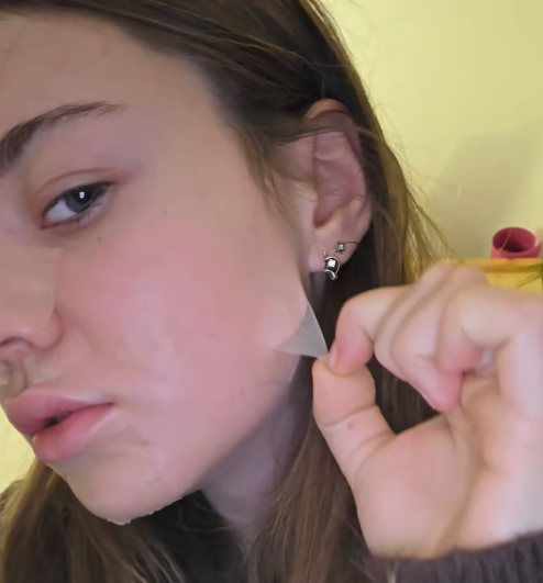 Hydrocolloid Pimple Patches